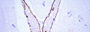 Primärantikörper für Western Blot